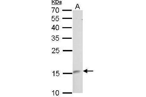 WB Image LMO1 antibody detects LMO1 protein by Western blot analysis. (LMO1 anticorps)