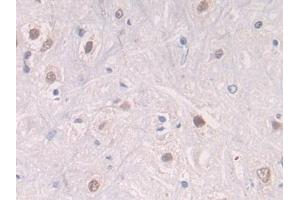 Detection of CTSG in Rat Spinal cord Tissue using Polyclonal Antibody to Cathepsin G (CTSG) (Cathepsin G anticorps  (AA 51-250))