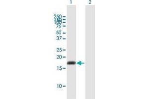 Western Blot analysis of CYP2U1 expression in transfected 293T cell line by CYP2U1 MaxPab polyclonal antibody. (CYP2U1 anticorps  (AA 1-168))