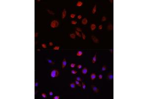 anti-V-Akt Murine Thymoma Viral Oncogene Homolog 1 (AKT1) (C-Term) antibody