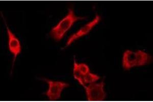 ABIN6276263 staining Hela by IF/ICC. (OR51A4 anticorps  (Internal Region))