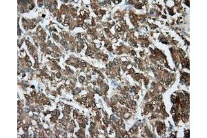 Immunohistochemical staining of paraffin-embedded pancreas tissue using anti-PIM2 mouse monoclonal antibody. (TPMT anticorps)