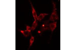 ABIN6274589 staining Hela cells by IF/ICC. (ARRDC3 anticorps  (C-Term))