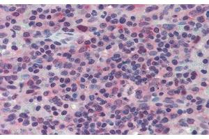 Detection of LAG3 in Human Spleen Tissue using Polyclonal Antibody to Lymphocyte Activation Gene 3 (LAG3)
