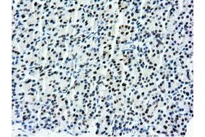 Immunohistochemistry (IHC) image for anti-5'-Nucleotidase Domain Containing 1 (NT5DC1) antibody (ABIN1499838)