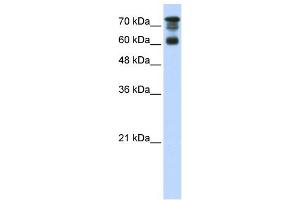 WB Suggested Anti-PPP1R13L Antibody Titration:  0. (PPP1R13L anticorps  (C-Term))
