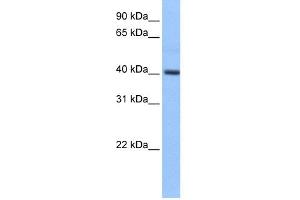 WB Suggested Anti-PDXK Antibody Titration: 0. (PDXK anticorps  (Middle Region))