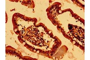 Immunohistochemistry of paraffin-embedded human small intestine tissue using ABIN7155403 at dilution of 1:100