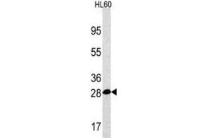Western Blotting (WB) image for anti-Proteasome Subunit alpha 5 (PSMA5) antibody (ABIN2998030)