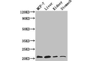 Western Blot Positive WB detected in: MCF-7 whole cell lysate, Mouse liver tissue, Mouse kidney tissue, Mouse stomach tissue All lanes: GNPNAT1 antibody at 3.