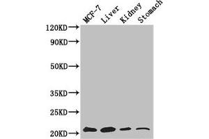 Western Blot Positive WB detected in: MCF-7 whole cell lysate, Mouse liver tissue, Mouse kidney tissue, Mouse stomach tissue All lanes: GNPNAT1 antibody at 3. (GNPNAT1 anticorps  (AA 1-184))
