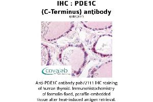 Image no. 1 for anti-phosphodiesterase 1C, Calmodulin-Dependent 70kDa (PDE1C) (C-Term) antibody (ABIN1737910) (PDE1C anticorps  (C-Term))