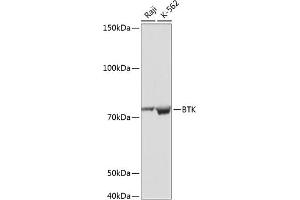 Western blot analysis of extracts of various cell lines, using BTK antibody (ABIN7265950) at 1:1000 dilution. (BTK anticorps)