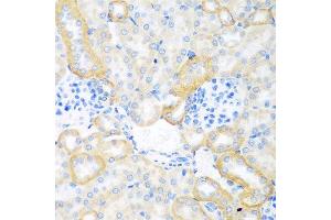 Immunohistochemistry of paraffin-embedded mouse kidney using CEACAM7 antibody at dilution of 1:100 (40x lens). (CEACAM7 anticorps)