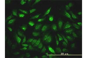 Immunofluorescence of monoclonal antibody to NCOA4 on HeLa cell.