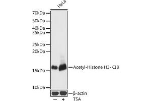 Western blot analysis of extracts of HeLa cells, using Acetyl-Histone H3-K18 antibody (ABIN7267668) at 1:500 dilution.
