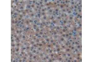 IHC-P analysis of Rat Tissue, with DAB staining. (Vitronectin anticorps  (AA 21-400))