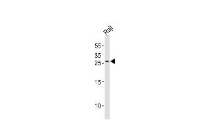 Anti-KITLG Antibody (C-term)at 1:1000 dilution + Raji whole cell lysates Lysates/proteins at 20 μg per lane.