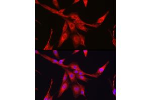 Immunofluorescence analysis of PC-12 cells using [KO Validated] Glutathione Synthetase (GSS) Rabbit pAb (ABIN7267451) at dilution of 1:100 (40x lens).