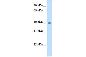 ABHD5 antibody used at 5 ug/ml to detect target protein. (ABHD5 anticorps  (N-Term))
