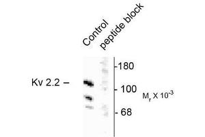 Image no. 1 for anti-Potassium Voltage-Gated Channel, Shab-Related Subfamily, Member 2 (KCNB2) antibody (ABIN372705) (Kv2.2 anticorps)