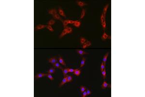 Immunofluorescence analysis of NIH/3T3 cells using Nesprin 1 Rabbit pAb (ABIN7270520) at dilution of 1:100 (40x lens). (SYNE1 anticorps)