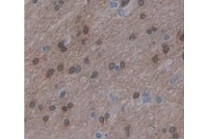 IHC-P analysis of Human Tissue, with DAB staining. (ZFHX4 anticorps  (AA 1-189))