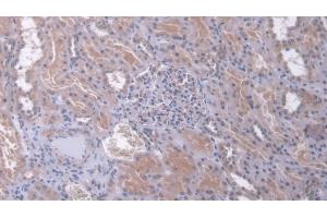 Detection of DUSP6 in Human Kidney Tissue using Polyclonal Antibody to Dual Specificity Phosphatase 6 (DUSP6) (DUSP6 anticorps  (AA 1-300))