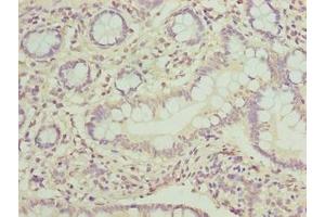 Immunohistochemistry of paraffin-embedded human small intestine tissue using ABIN7162860 at dilution of 1:100