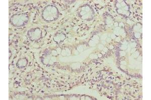 Immunohistochemistry of paraffin-embedded human small intestine tissue using ABIN7162860 at dilution of 1:100 (PPIL3 anticorps  (AA 2-161))