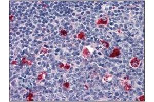 Immunohistochemistry (IHC) image for anti-Cathepsin D (CTSD) (AA 21-412) antibody (ABIN317502) (Cathepsin D anticorps  (AA 21-412))