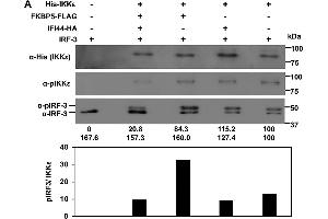 IFI44 decreases the kinase activity of IKKβ and IKKε.