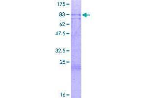 Image no. 1 for Zinc Finger Protein 280A (ZNF280A) (AA 1-542) protein (GST tag) (ABIN1326067)
