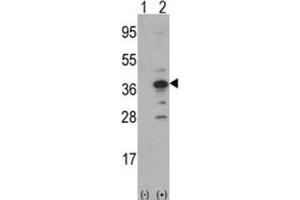 Western Blotting (WB) image for anti-DNA Segment, MCA1, Multiple CA Repeat 1 (MCA1) antibody (ABIN3002773) (MCA1 anticorps)