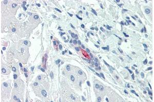 Anti-SLC5A1 / SGLT1 antibody  ABIN1049342 IHC staining of human liver. (SLC5A1 anticorps  (Internal Region))