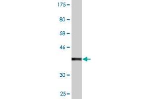 Western Blot detection against Immunogen (37. (SCYL3 anticorps  (AA 553-660))