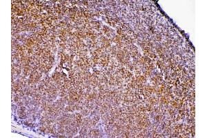 IHC analysis of PTPN22 using anti-PTPN22 antibody .