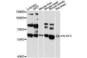 Western blot analysis of extracts of various cell lines, using ACSF3 antibody (ABIN6292804) at 1:3000 dilution.