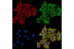ACVL1 Mouse Monoclonal Antibody staining HepG2 cells by IF/ICC.