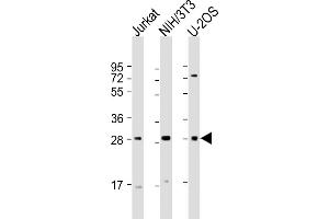All lanes : Anti-SIX1 Antibody (Center) at 1:2000 dilution Lane 1: Jurkat whole cell lysate Lane 2: NIH/3T3 whole cell lysate Lane 3: U-2OS whole cell lysate Lysates/proteins at 20 μg per lane. (SIX Homeobox 1 anticorps  (AA 69-102))