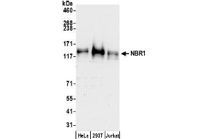 Western Blotting (WB) image for anti-Neighbor of BRCA1 Gene 1 (NBR1) (AA 916-966) antibody (ABIN7450479)
