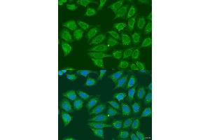 Immunofluorescence analysis of U2OS cells using  antibody (ABIN6131173, ABIN6136581, ABIN6136582 and ABIN6223850) at dilution of 1:100. (ADH7 anticorps  (AA 1-386))