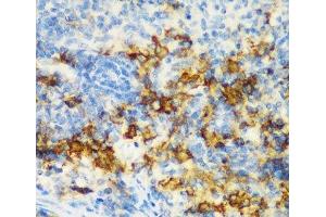 Immunohistochemistry of paraffin-embedded Rat spleen using CD3D Polyclonal Antibody at dilution of 1:200 (40x lens).