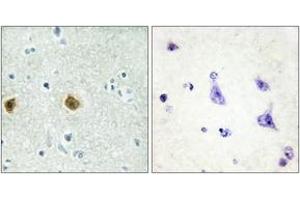 Immunohistochemistry analysis of paraffin-embedded human brain tissue, using NDUC2 Antibody. (NDUFC2 anticorps  (AA 51-100))