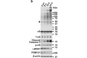 Apoptosis induces αS aggregation and phosphorylation in BE(2)-M17D/3D5 cells.