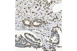 IHC analysis of HP1 alpha/CBX5 using anti-HP1 alpha/CBX5 antibody (ABIN7599058). (CBX5 anticorps  (AA 1-191))
