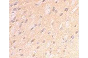 Immunohistochemical staining of rat brain using AP30071PU-N APP antibody at 2 μg/ml. (APP anticorps  (C-Term))