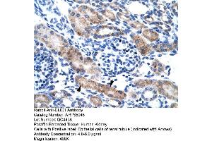 Human kidney (CLIC1 anticorps  (N-Term))