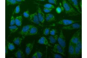 IF analysis of FIS1 using anti-FIS1 antibody (ABIN7598965). (Fission 1 anticorps  (AA 1-121))