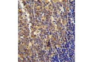 Immunohistochemistry analysis in formalin fixed and paraffin embedded human tonsil tissue reacted with LYRM4 Antibody (Center) followed which was peroxidase conjugated to the secondary antibody and followed by DAB staining.